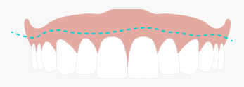 teeth_a2.jpg