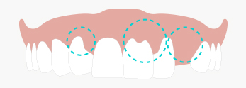 teeth_a4.jpg